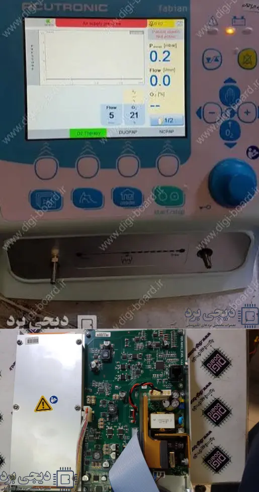 تعمیر دستگاه ونتیلاتور