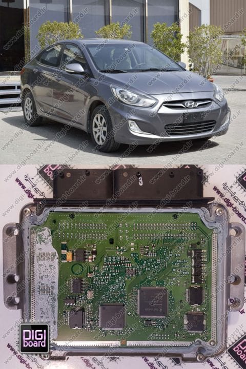 تعمیر ای سی یو ECU هیوندای اکسنت