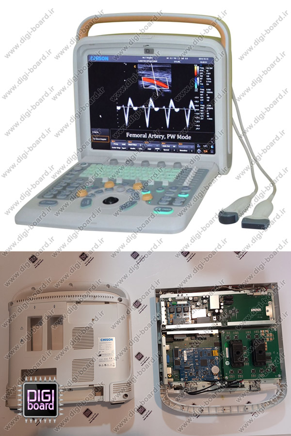 تعمیر دستگاه سونوگرافی CHISON Q9