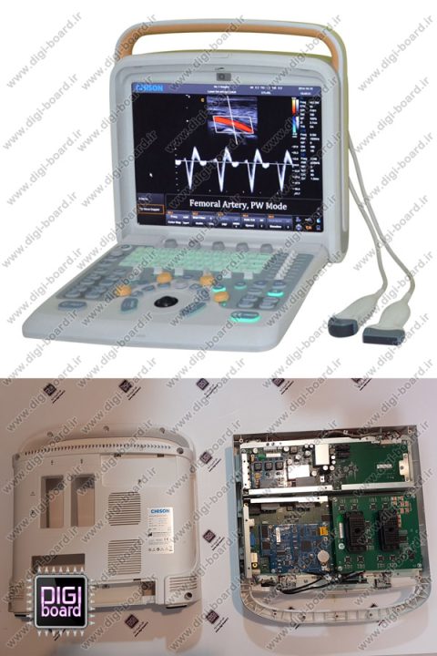 تعمیر دستگاه سونوگرافی CHISON Q9